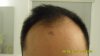 Hairline_201305.jpg Hairline_201305.jpg