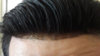 hairline.jpg