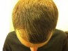 desired_hairline.jpg desired_hairline.jpg