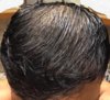 13 months after transplant, damp hair2.jpg