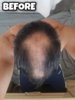Before.jpg