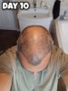 Day 10.jpg