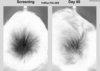 Follica_Hair_Results_Before_After_Close_Up_Invert.jpg