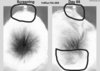 Follica_Hair_Results_Before_After_Close_Up_Invert-details.jpg