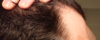 hairline_right.png