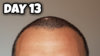 Day 13 Hairline.jpg