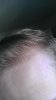 newhairline.jpg