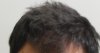 wider hairline and thick.jpg