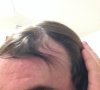 bad forntal hairs.jpg bad forntal hairs.jpg