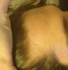 hairline1.jpg