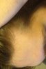 hairline2.jpg