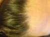 hairline3.jpg