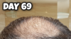 Crown 69.png