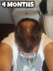 4 Months Top.png