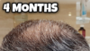 4 Months Crown.png