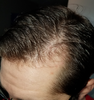 Neohairline.png