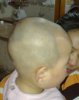 very young children with scalp sebum.jpg
