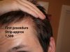 First procedure strip.jpg