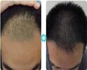 10mg-Tripeptide-hair-growth-peptide-cosmetic-material-hair-growth-prevention-hair-loss-prevent...jpg