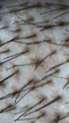 Hair Follicle 2.jpg