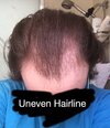 Hairline.JPG