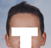 Hairline choice 12.png