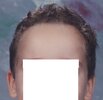 Hairline choice031.jpg