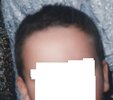 Hairline choice034.jpg