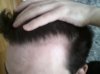 hairline 833.jpg