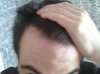 hairline 832.jpg