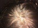 Crown Wet Hair + Lightning.JPG