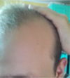 hairline.png