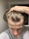 Hairline May 2021.jpg