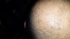 1 week post shave baseline.jpg 1 week post shave baseline.jpg