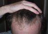 hair-front.JPG hair-front.JPG