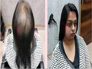 Hair wigs image.jpg