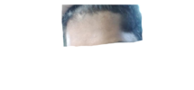 Hairlinetilt1.png