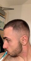 3-4 months into finasteride 1mg and minoxidil 5% rogaine (2).JPG