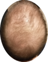 bald.png
