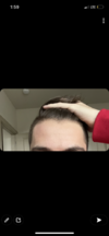 hairline.png