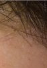 hairline zoom.jpg hairline zoom.jpg