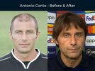 Antonio-Conte-Hair-Transplant-Before-After.jpg