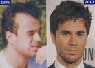 enrique-iglesias-balding-bald.jpg