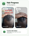 follicle_progress_card_1782489730324.png.png