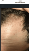 C14FF7F8-300F-4DA4-97A2-F4EDD549A701.png