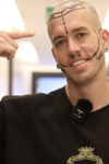 hair transplants cheaper in Turkey.png hair transplants cheaper in Turkey.png