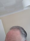 forehead temples.jpg