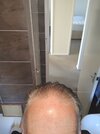 forehead.jpg