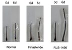 Ex_vivo_AGA_study_RUbedo_Q3_2026.jpg