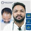 nilesh-gorde-2500-grafts-hair-transplant-8-month-result-pune.jpg-50kb.jpg